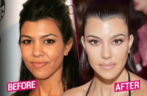 Kourtney Kardashian Plastic Surgery - With Before And After 