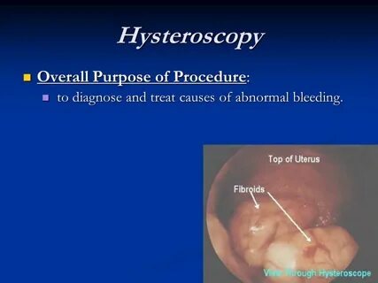 OB-GYN Procedures Operative Sequence - ppt video online down