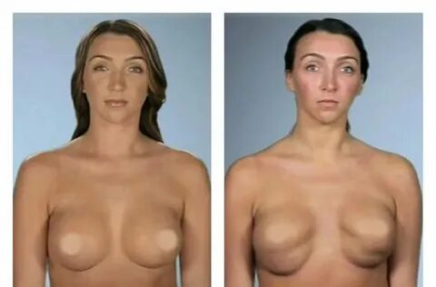 Plastic surgery porn