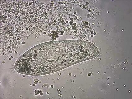 Amoeba Under Microscope 40X / Paramecium caudatum - mit Moti