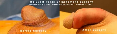 Independent study on penis enlargement - Hot Naked Girls Sex