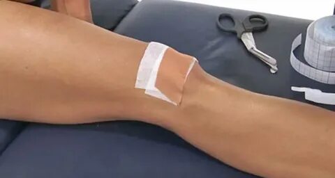 Patellofemoral Pain Taping - How To Tape The Patella Step By
