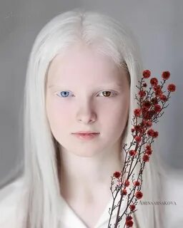 Pin by Alena on Лица Albinism, Albino girl, Ethereal beauty