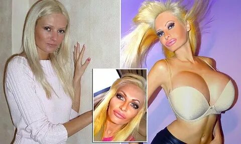 Victoria Wild has £ 30k worth of plastic surgery to look lik