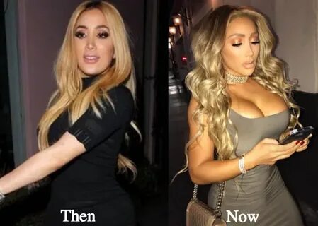 Nikki Mudarris (Nikkibaby) Before Plastic Surgery and After 