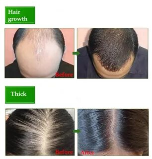 Купить Dimollaure средство для роста волос против выпадения 