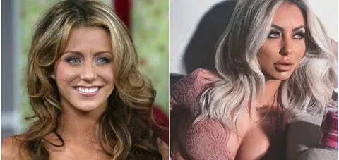 Aubrey Oday Plastic Surgery . url: https://plasticessurgery.