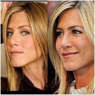 Jennifer Aniston nose job Jennifer aniston nose, Jennifer an