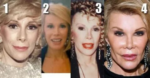 Joan Rivers Before and After Plastic Surgery Photos Plastic 