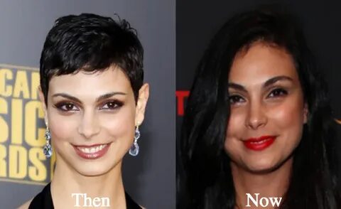 Morena Baccarin boobs plastic surgery before and after photo