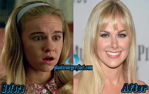 Úzce Alternativní návrh pověst laura bell bundy nose dopad M