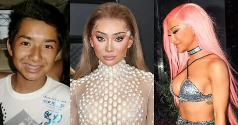 Nikita Dragun's Plastic Surgery: Before and After On Instagr