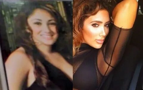 LAHH Star Nikki Baby Transformation After Plastic Surgery - 