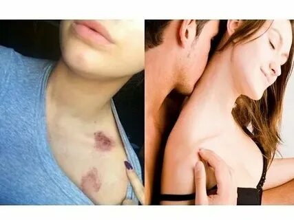 How to Give Someone a Hickey (step by step) - YouTube