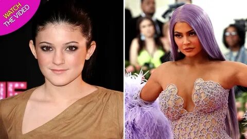 Kylie Jenner Before And After Plastic Surgery - Plastic Indu