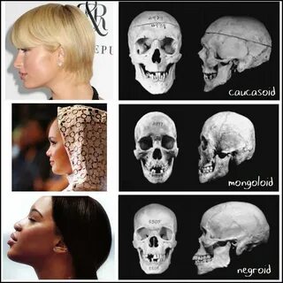 Craniofacial anthropometry