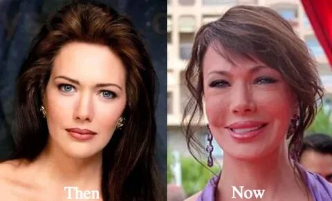 Hunter Tylo Plastic Surgery Before and After Photos - Latest
