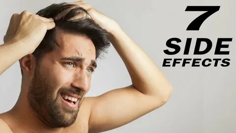 TOP 7 HAIR TRANSPLANT SIDE EFFECTS! - YouTube