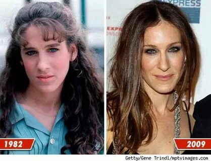 Sarah Jessica Parker Plastic Surgery Before and After Photos