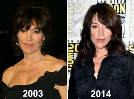 Katey Sagal Plastic Surgery - Plastic Industry In The World