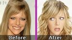Kaitlin Olson Plastic Surgery, Body measurements, Before and