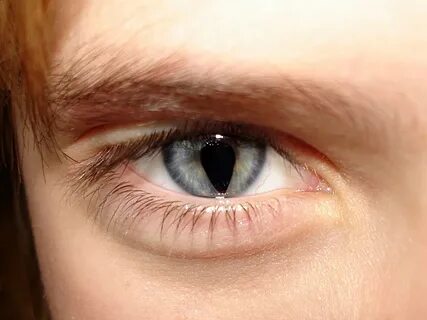 У некоторых людей зрачки глаз похожи на замочные скважины