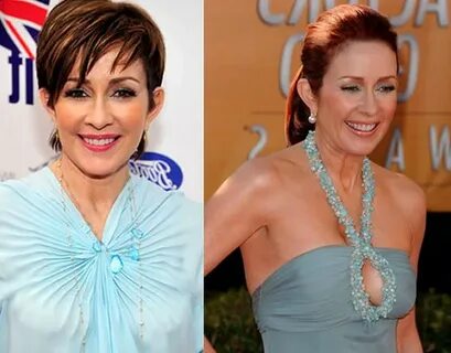 Patricia Heaton looking great after plastic surgery