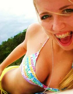 Teen Braces Bikini