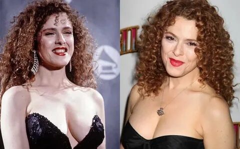 Bernadette Peters Plastic Surgery Celebrity plastic surgery,