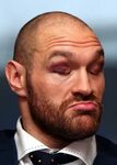 Welcome Home! Fury's First British Press Conference - Read B