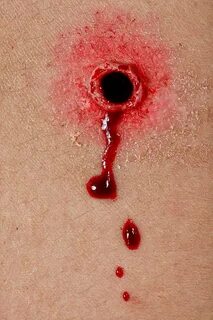 Gunshot Wound Images Pictures - Сток картинки - iStock