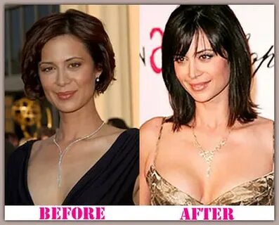 Catherine Bell Plastic Surgery Before After The Catherine . 