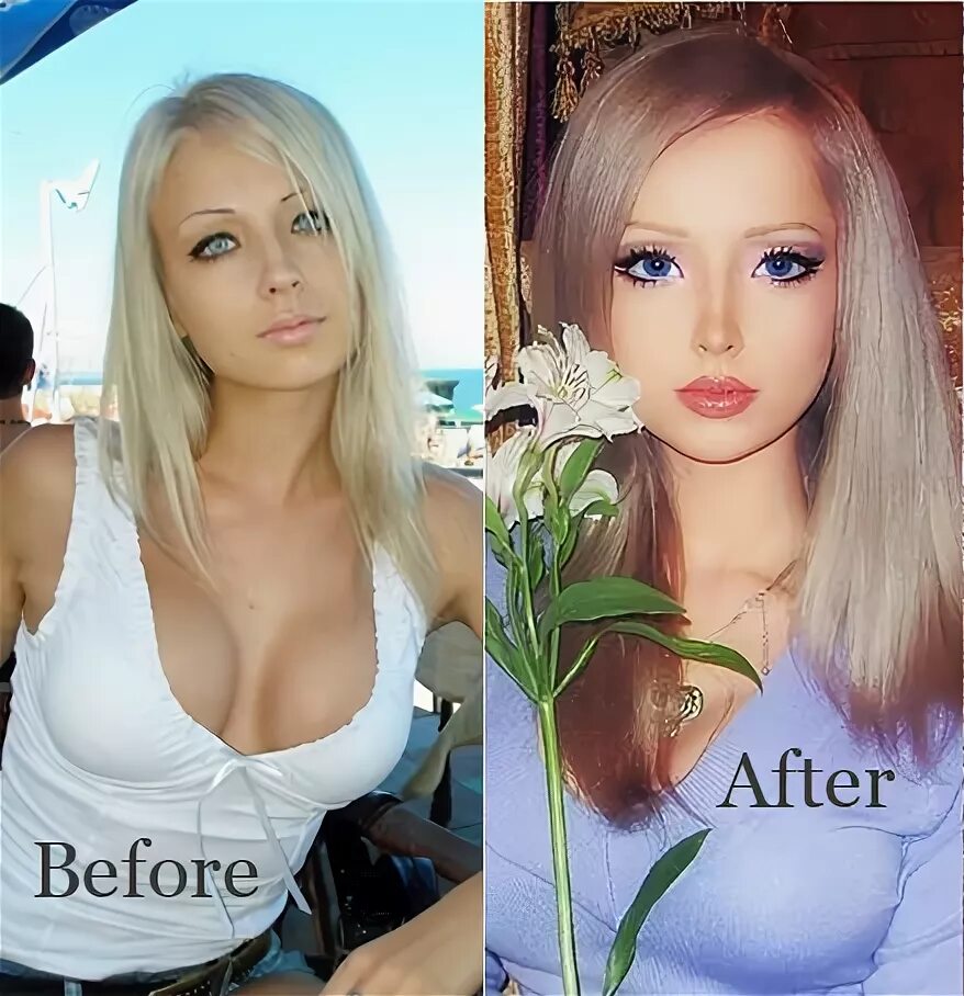 valeria lukyanova surgery Shop Clothing & Shoes Online