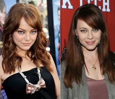 Emma Stone before and after plastic surgery 5 Celebrity plas