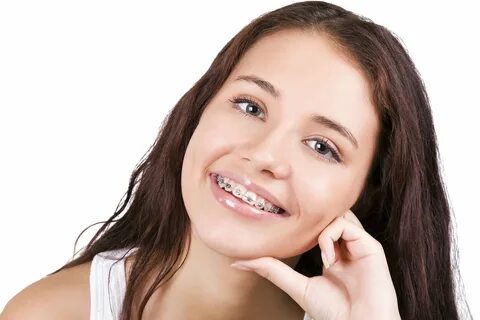 What to know before getting braces? The patient’s perspectiv