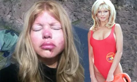 Baywatch star Donna D'Errico left bloody and bruised after d