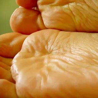 wrinkled soles. i was surprised to see how wrinkled my fee. 