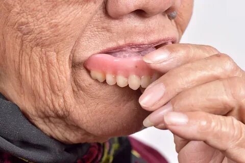 Taking Your Dentures Out To Dinner - Island Dental Associate