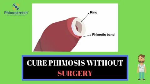 Cure phimosis and solve tight foreskin without Circumcision 