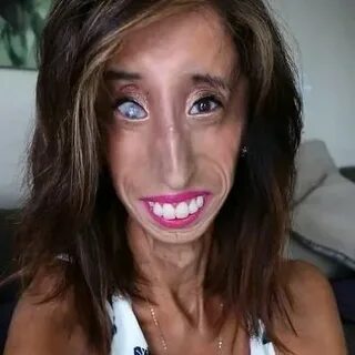 World's Ugliest Woman, Lizzie Velasquez Fighting Strongly In