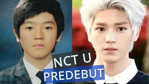 Yuta plastic surgery - Plastic Surgery