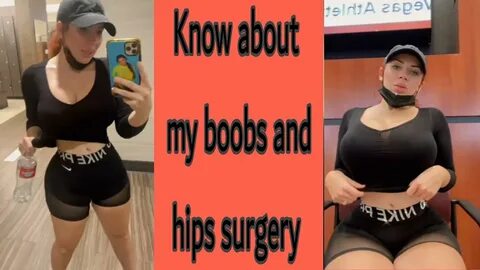 Know about my plastic surgery by Amanda Nicole - YouTube