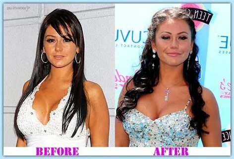 Jwoww Pre-surgery Related Keywords & Suggestions - Jwoww Pre