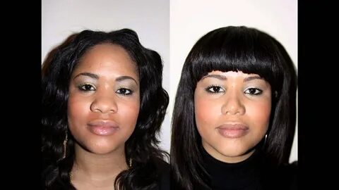 African American Female Rhinoplasty NYC Before & After Dr. S