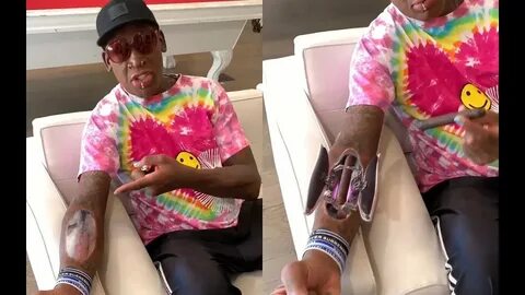 NBA Legend Dennis Rodman Gets A Cigar Implant In His Arm - Y