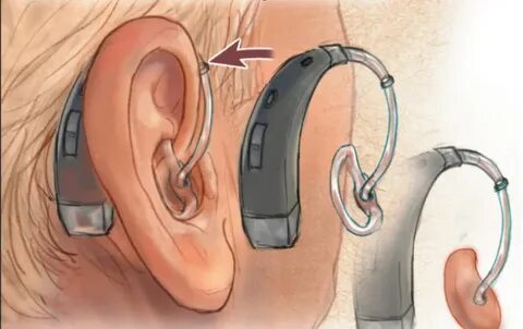 Rechargeable Hearing Aids - Types of Hearing Aids - Natural 