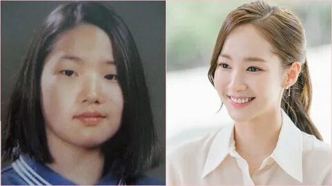 Admitting to Receiving Plastic Surgery, Let's Compare Park M