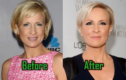 Mika Brzezinski: Plastic Surgery for Facelift? Before-After!