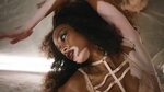 Love Advent 2017 - Day 15: Winnie Harlow - The Fappening