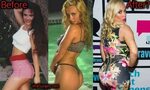Coco Austin Plastic Surgery: Before and After Breast, Butt I